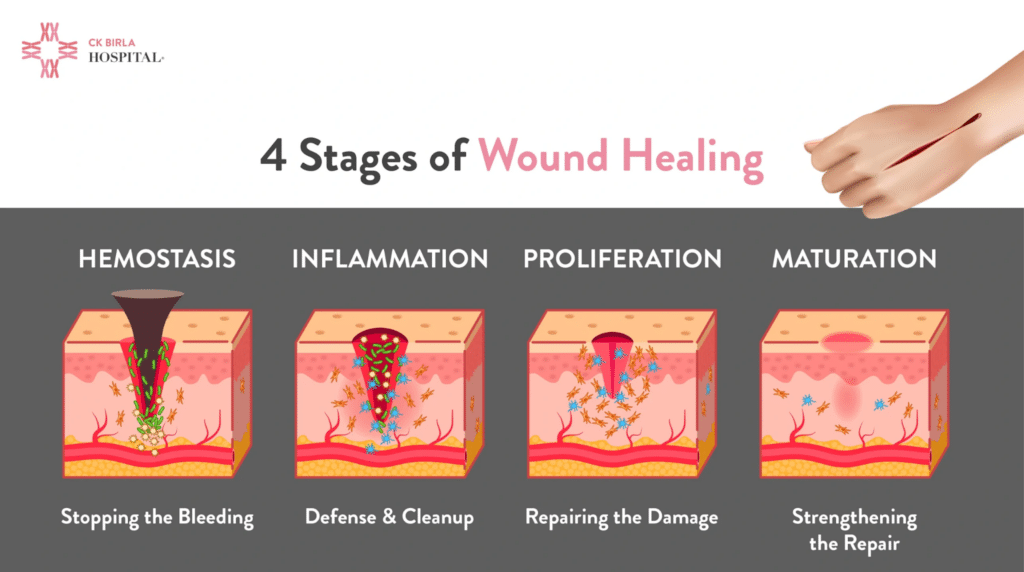 cold plunge and open wounds