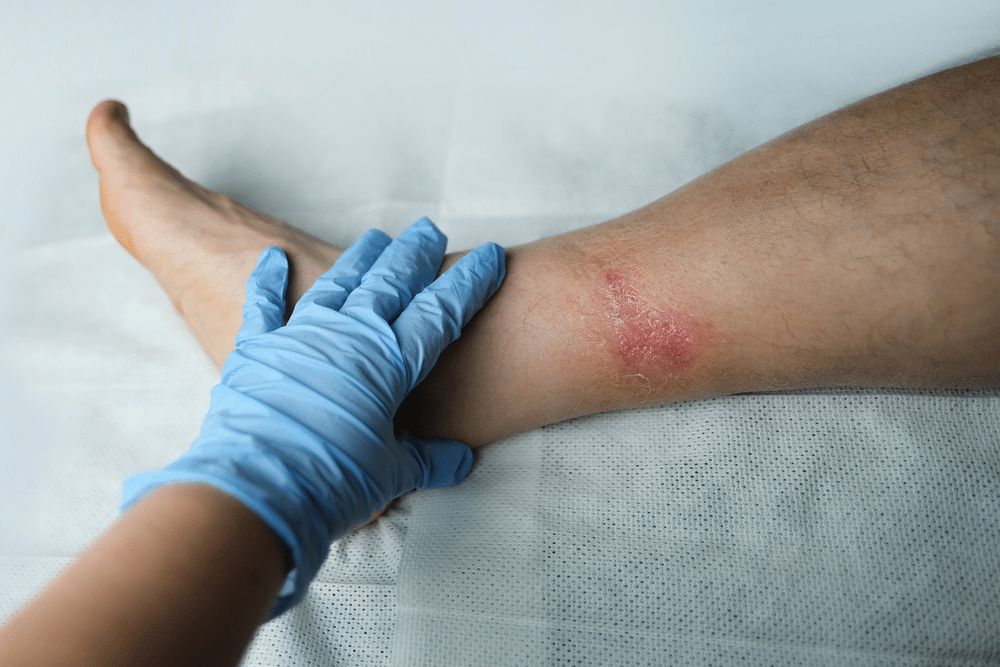 sauna infection risk